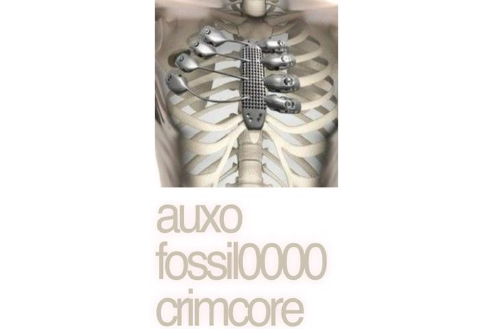AUXO.